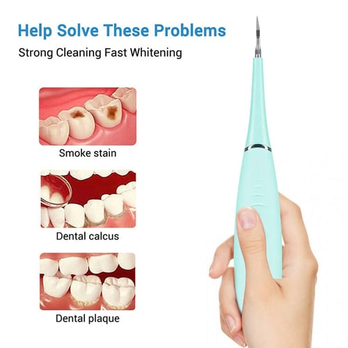 Electric Sonic Dental Scaler Teeth Whitening Home Use Tooth Stain Remover Tartar Scaling Usb Charging High Frequency Vibration Dentist Tools With Clip Probe Pink - Diy Dental Tartar Removal Tool Electric Sonic Dental Scaler Teeth Whitening Home Use Tooth Stain Remover Tartar Scaling Usb Charging High Frequency Vibration Dentist Tools With Clip Probe Pink - Diy Dental Tartar Removal Tool
