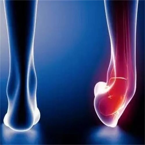 Yoga Ligament Stretching Belt Foot Drop Strap Leg Training Foot Correct Ankle UK 