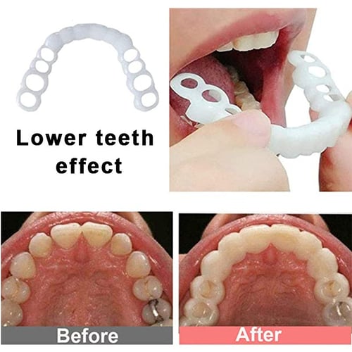 1pair Silicone Fake Teeth False Tooth Cover Whitening Denture Oral Care Tool
