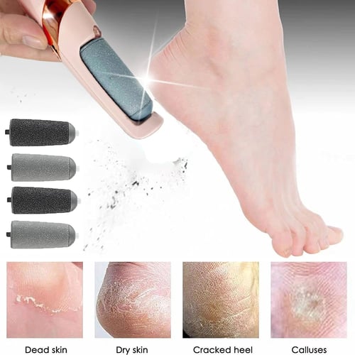 Pedicure Rasp Foot File Callus Remover For Hard And Chapped Corns, Feet  Scrubber Scrubber Cleaner F