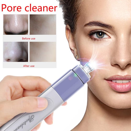 Electric Blackhead Remover Vacuum Acne Cleaner Black Spots Removal Facial  Deep Cleansing Pore Cleaner Machine Skin Care Tools