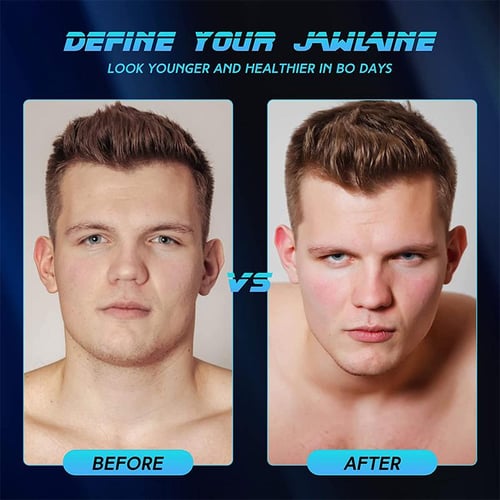 Jaw lift exercise clearance