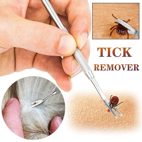 Flea and tick on sale removal