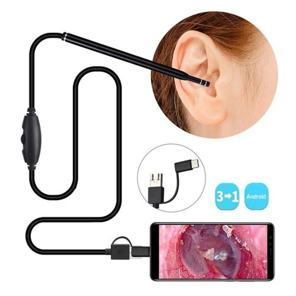 3 in 1 ear endoscope